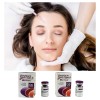 50IU 100U 150UI BTX Botulinum Toxin Type A Botox Allergan